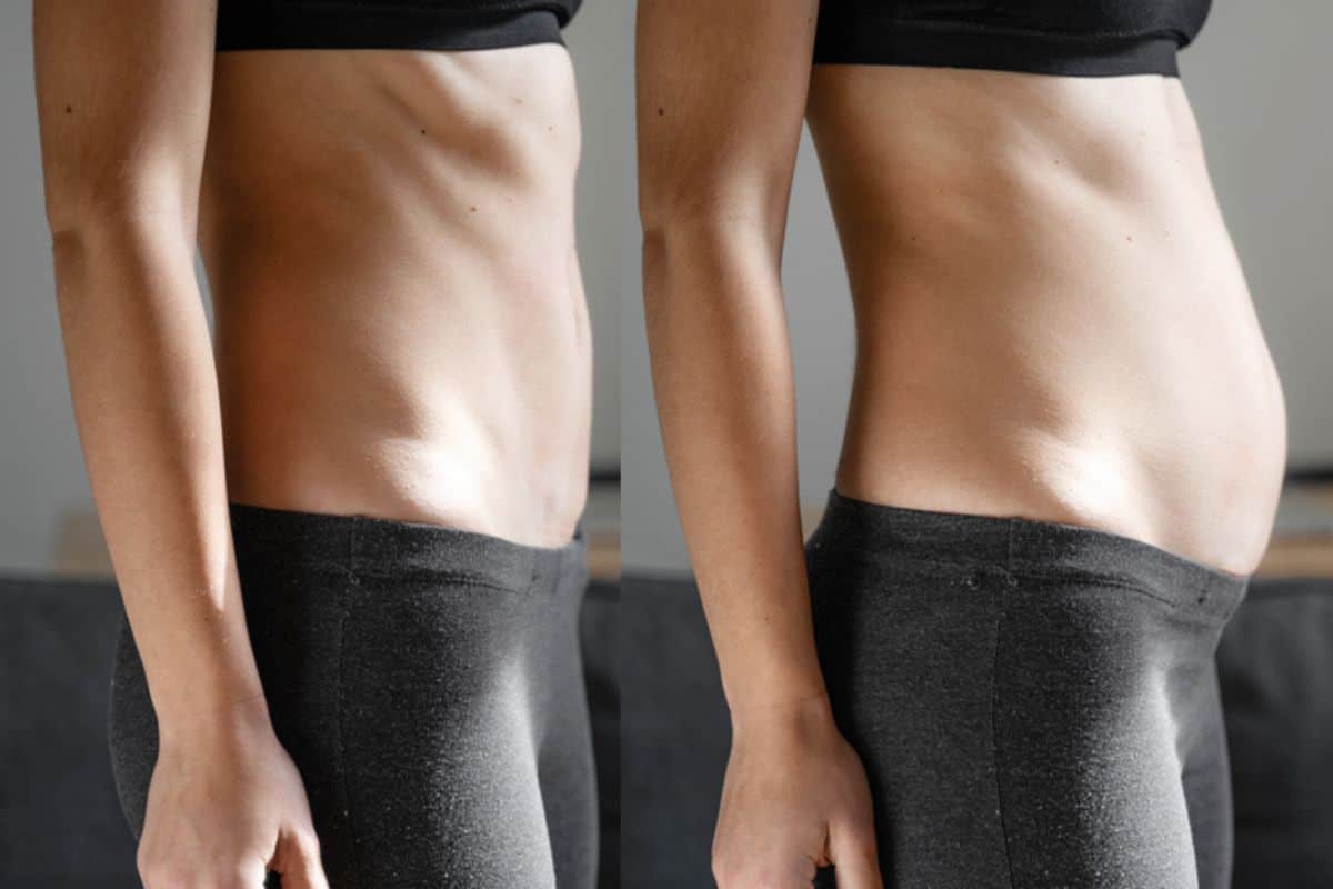 How long does diastasis recti take to improve Warwickshire?