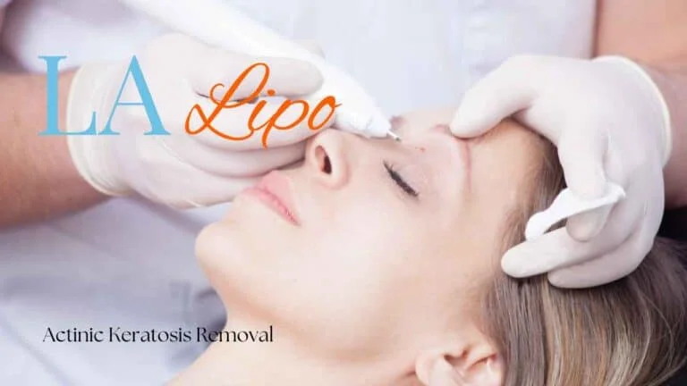 Woman receiving Actinic Keratosis Removal Treatment Warwickshire