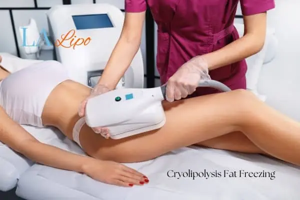 Woman receiving coolsculpting Warwickshire treatment on her thighs
