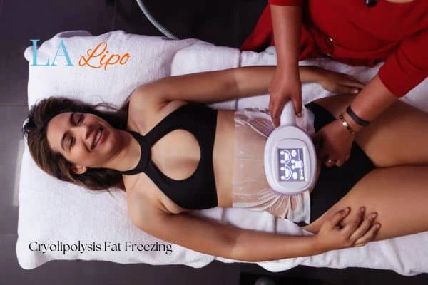 woman getting cryolipolysis Warwickshire