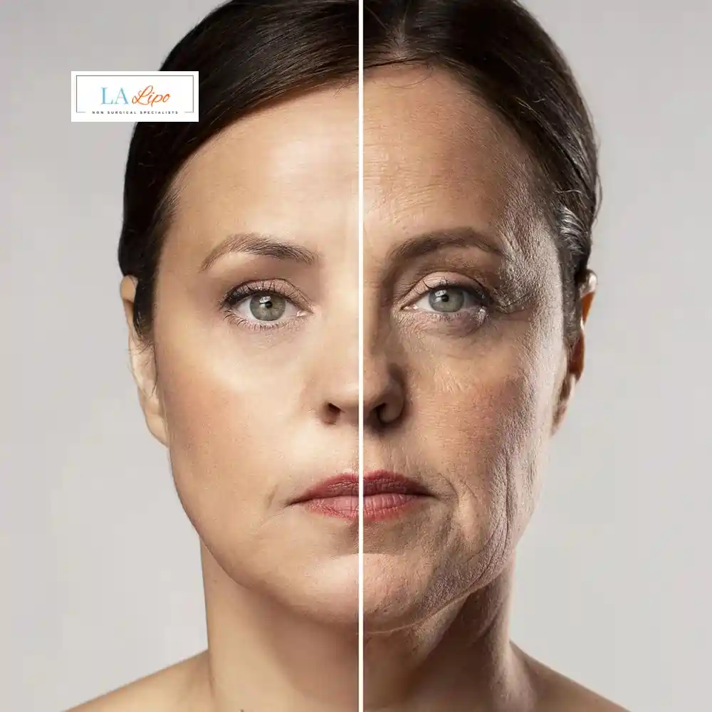 How Can You Tell If Non-Surgical Skin Tightening Is Right for You Warwickshire?