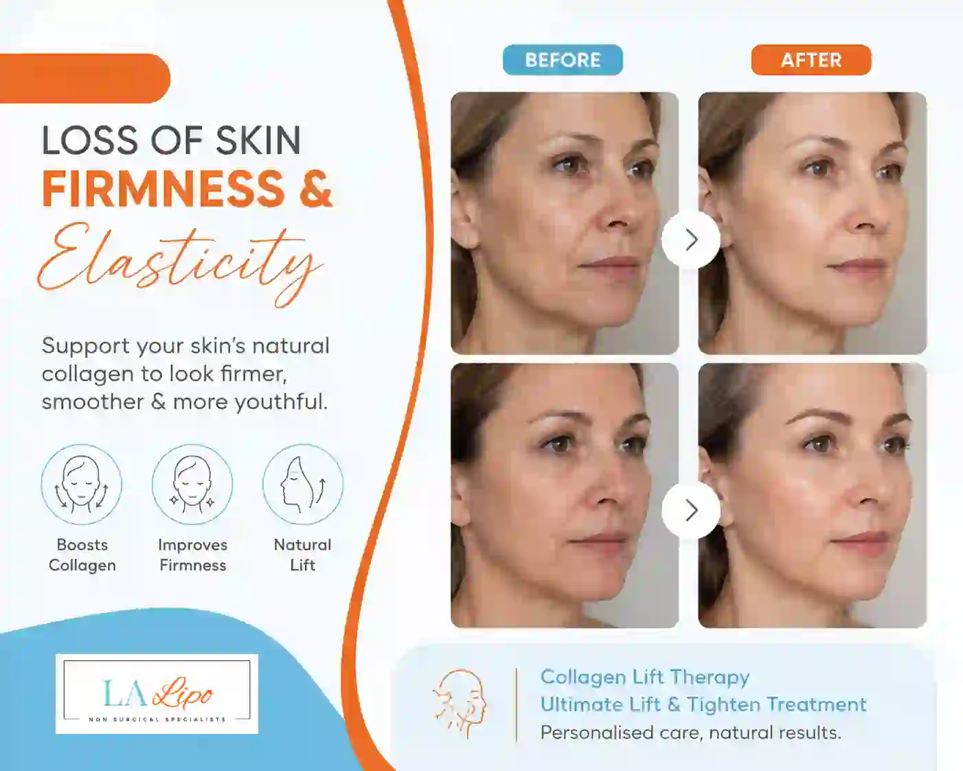 Sign #7: Loss of Skin Firmness and Elasticity Warwickshire