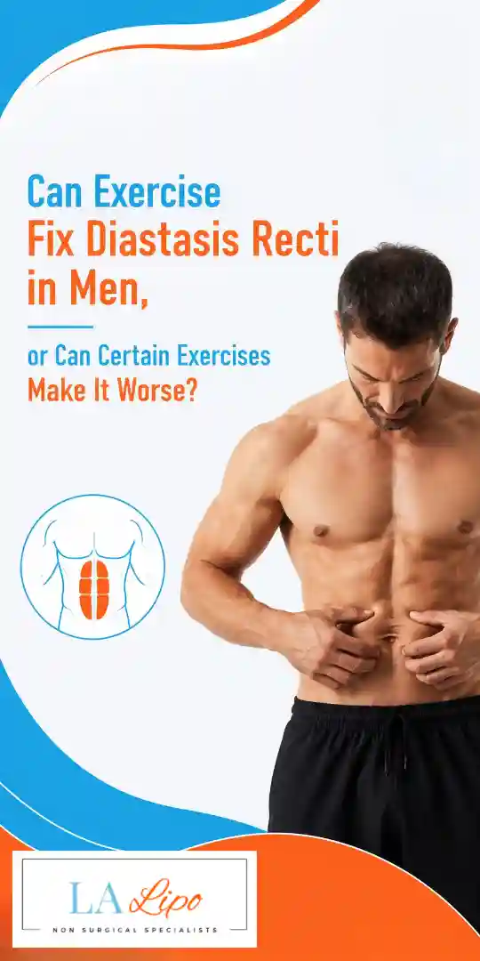 Can Exercise Fix Diastasis Recti in Men, or Can Certain Exercises Make It Worse Warwickshire?
